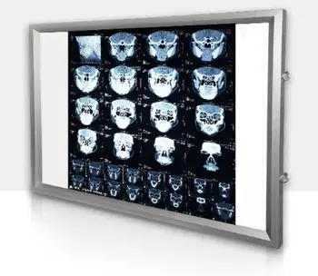 100-240V Ligoninės rentgeno nuotraukų lempos Odontologijos ortopedijos Touch kontrolės X-Ray Filmų Apšvietimas Šviesos Lange X-ray Žiūrovas