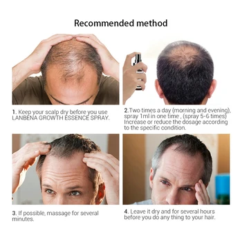 Plaukų Augimo Esmė Purškimo Prevencijos Nuplikimas Stiprinant Kovos Su Plaukų Slinkimas Stiprus Maitina Plaukų Šaknis, Plaukai Atauga F